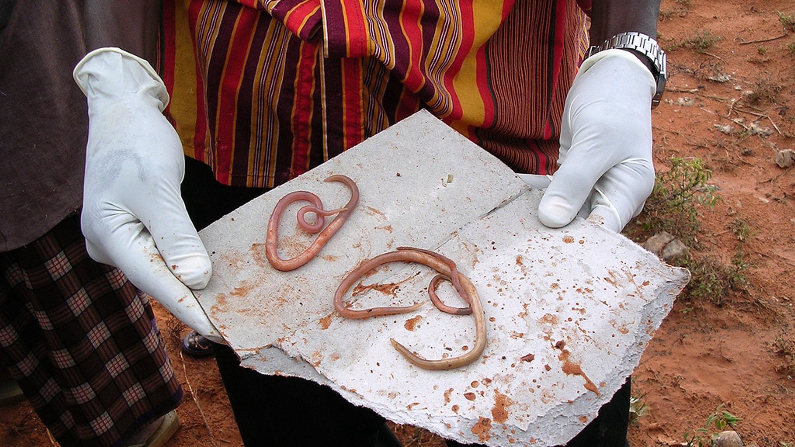 Soil Transmitted Helminths