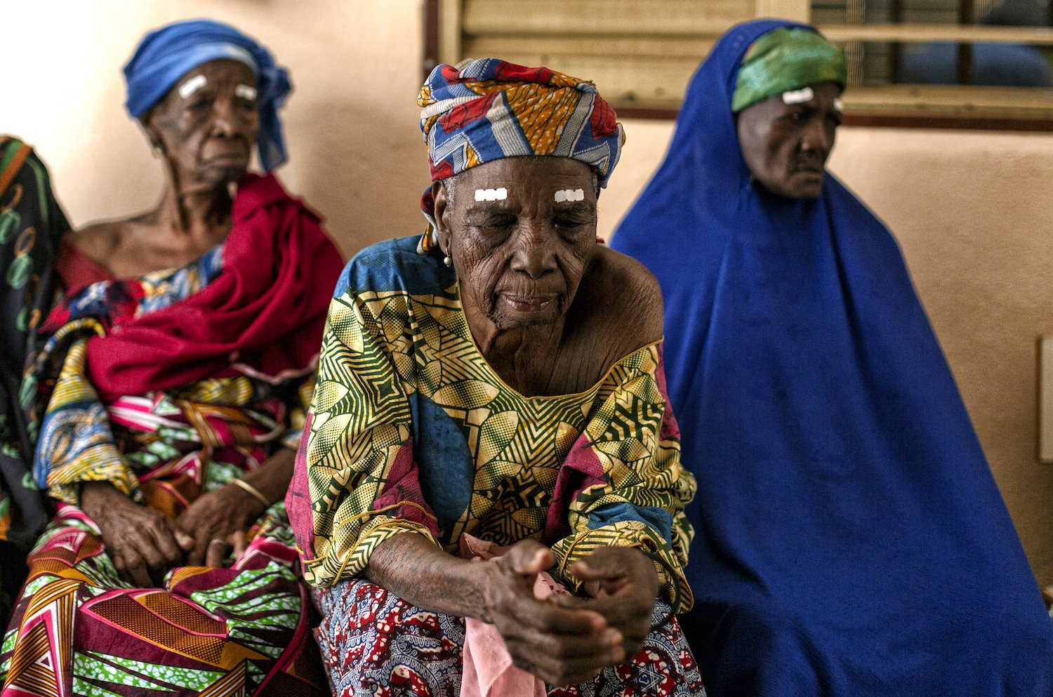 A woman suffering from trachoma awaits surgery that will bring her sight back in the Centre de Sante Biro, Benin.
