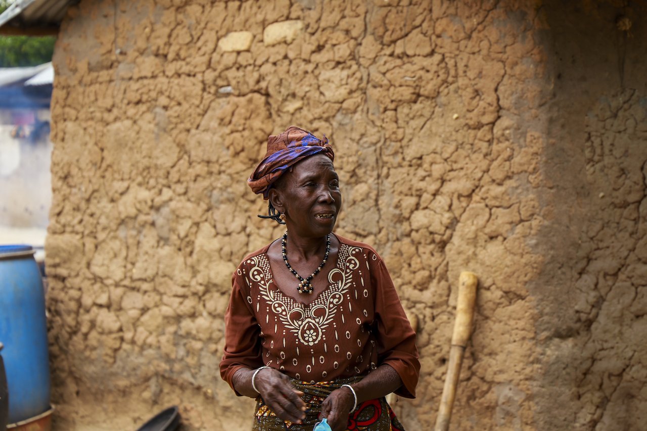 Safia Worou stands poses for a portrait after her surgery in Borgou department, Benin