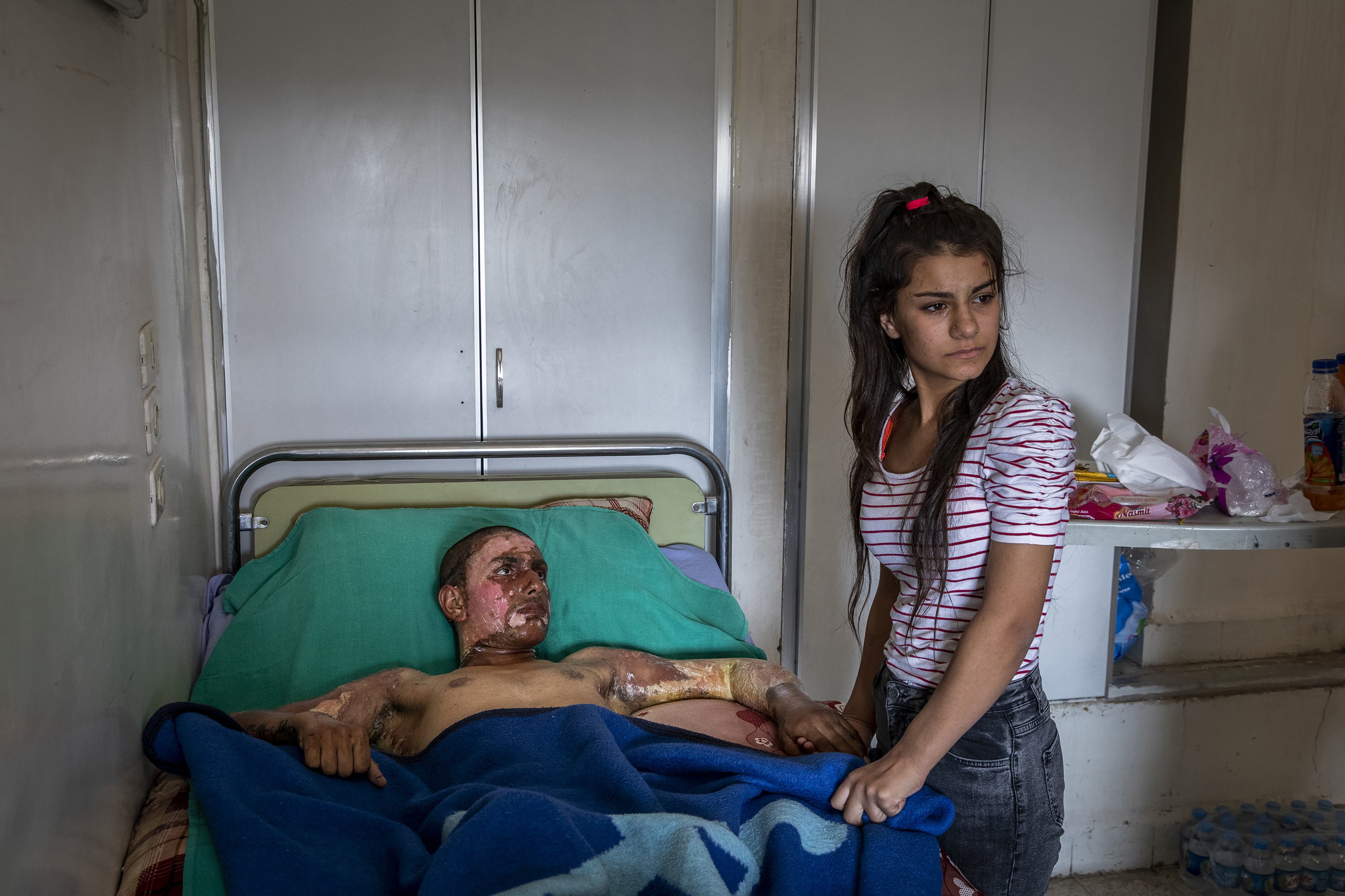 Ahmed Ibrahim, an 18-year-old SDF fighter badly burned in conflict with Turkish forces, is visited by his girlfriend at a hospital in Syria, on Oct. 20, 2019. She had been too horrified by his injuries to see him, but a nurse encouraged her to go in.